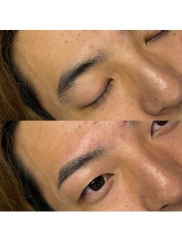 ニューフェイス(NEW FACE)/before/after