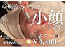 ステラグランデ(Stella grande)