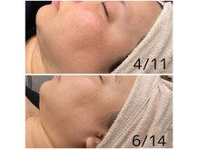 ココ(Coco)の雰囲気(当店人気急上昇中♪うなじ脱毛&背中脱毛!回キャンペーンあり!)