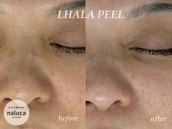 ナルカ(naluca)/【堺市・なかもず】ララピール