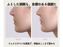 りんぱサロン まりの雰囲気（たるみ・むくみ土台から改善小顔ケア）