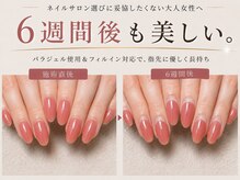 ヴィセオ(Viseo)