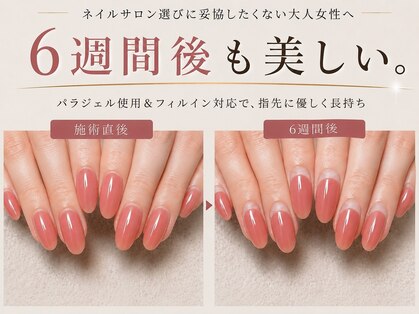 ヴィセオ(Viseo)の写真