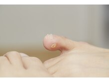 ナチュラル フット ネイル(Natural Foot Nail)の雰囲気（足のお悩みに特化したサロンです♪魚の目・タコも！）