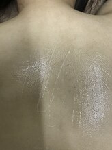 ナノハナ/鹿沼市本格脱毛の美容室ナノハナ