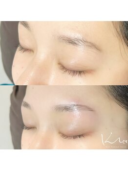 クレー(Klee)/アイブロウリフト