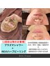 【殺菌力＆艶肌♪】プラズマシャワー＋REVI剥離なしハーブピーリング16000円