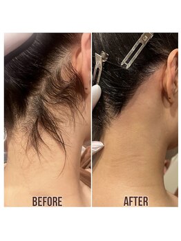 メローワックス 松本駅前店(MELLOW WAX)/大人気うなじワックス！