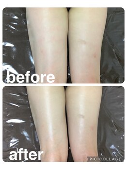 ギンザアール(GINZA R.)/下半身に集中アプローチ！