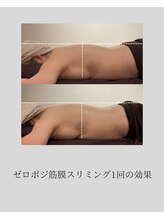 ベレーザ(Beleza.)/平らな背中ラインへ