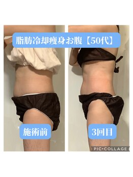 パラアモール(Paraamor)/ブカブカ洋服卒業できる!