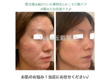 タイカ(Taika)の雰囲気（あなたの理想なお肌を応援！お悩み解放近道サポートします！）