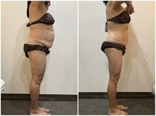 美容整体ウェリナ あま甚目寺院/小顔矯正/骨盤矯正/美脚サロン