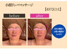 カジュアルエステサロン 爽やか 岡崎店/小顔リンパマッサージ