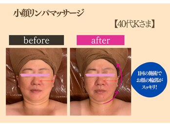 カジュアルエステサロン 爽やか 岡崎店/小顔リンパマッサージ