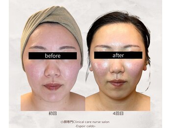 エスポワールカルド(Espoir caldo)/