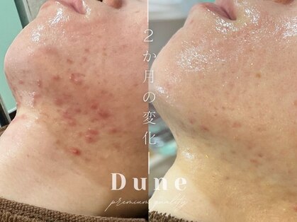 デューン 蕨店(Dune)の写真