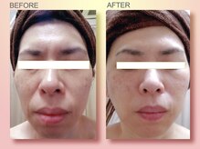 ジュリア オージェ 京橋店/ビフォーアフター（フォトFa)