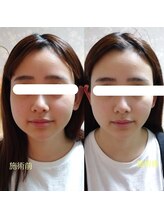 ドーズオフ(doze_off)/ドライヘッドスパ＋アイスパ