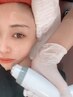 【ICE RF facial】小顔×リフトアップ☆即日お顔をキュッと引き締め☆ケア込