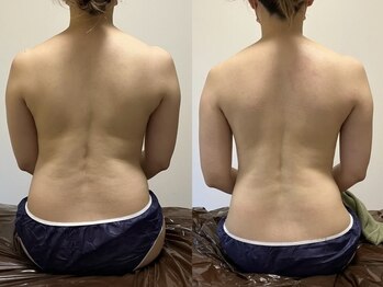 リセット(Reset.)/深層筋リンパ/ before → after