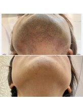 エピシアドットエヌ(epicia.N)/大変化！！