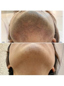 エピシアドットエヌ(epicia.N)/大変化!!