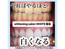ホワイトニングサロン ホワイト(WHITE)/セルフホワイトニング/大阪/福島