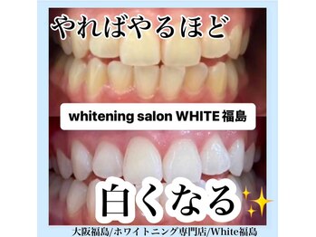 ホワイトニングサロン ホワイト(WHITE)/セルフホワイトニング/大阪/福島