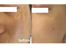 エルマナ(Hermana)/