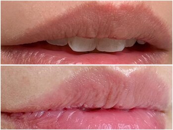 ピンクアンドプラウドサロン 横浜(Pink& Proud Salon)/ローマピンク【唇】