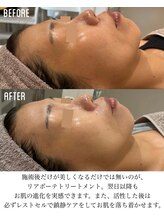 コアラッシュ 福井フェニックス通り店(COA LASH)/本来のお肌へ導くトリートメント