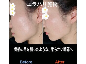 美容矯正サロン レレポノ(LELEPONO)/