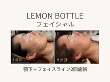 ビーモア(B.MORE)/2回でも変わる｜小顔印象
