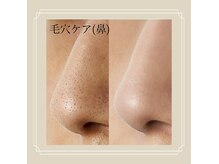 望月整体院の雰囲気（毛穴/鼻/毛穴洗浄/毛穴ケア/いちご鼻/フェイシャル/エステ）