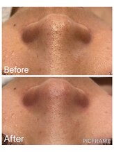 ジュエッテ(jouete)/水光アクアピール