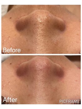 ジュエッテ(jouete)/水光アクアピール