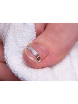 爪の悩みを解消できる（ケア含む）