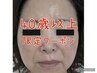《40代以上の方限定》毛穴レス徹底追及ピーリング！！¥9500-