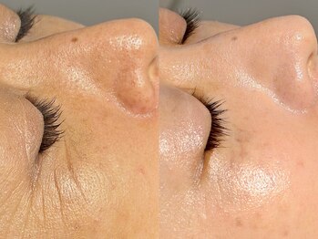 ルーナジェーナ(Luna llena)/池袋 エステ ルーナジェーナ