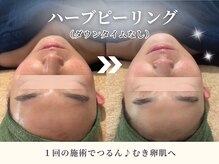 エム(M)の雰囲気（[ハーブピーリング]お悩み別に◎根本改善の剥離/ダウンタイム無）
