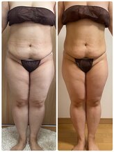 プラム(plum)/セルゼロ2