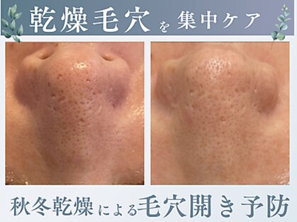 エヌエースキン たまプラーザ店(NAskin)の写真