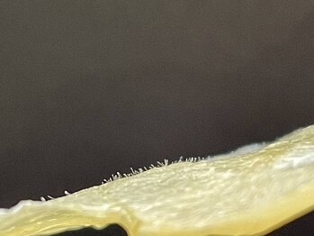 ヒーリングヘッドストーリー(healing head story)/マツヤニホットセラピー効果