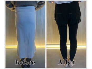 整体ラルース 中目黒(LALUZ)/30代 女性 産後骨盤矯正 変化