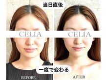 セリア(CELIA)