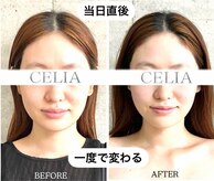 セリア(CELIA)