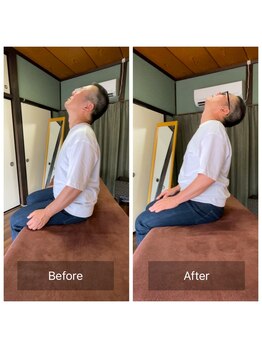 ミントのかべの整体院/施術ビフォーアフター