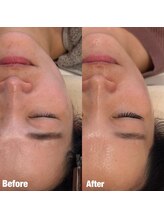 ペネロピ(Penelope)/フラットラッシュ×ララピール