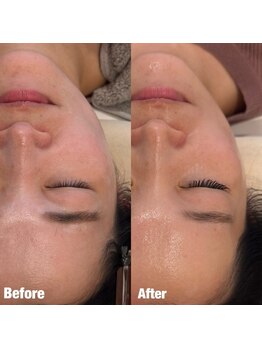 ペネロピ(Penelope)/フラットラッシュ×ララピール